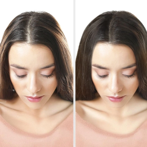Qr678 Hair Growth Treatment